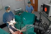 “Cậu nhỏ” không xuất tinh sau tán sỏi bàng quang