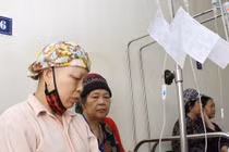 Nguyên nhân bị rụng tóc khi truyền hóa chất 