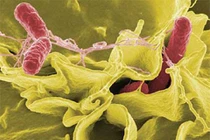 Nhận biết vi khuẩn "ăn ruột" cực kỳ nguy hiểm