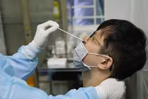 Một ca dương tính SARS-CoV-2 ở Hà Nội có lịch trình phức tạp