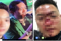 Fan minh oan cho Chiến Thắng vụ kêu vệ sĩ đánh khán giả 