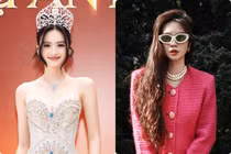 Hot face sao Việt: Ý Nhi được khen nhuận sắc sau “dao kéo“