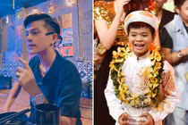 Quán quân Quang Anh thay đổi thế nào sau phẫu thuật thẩm mỹ?