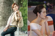 Huyền Lizzie thăng hạng nhan sắc sau khi sửa mũi