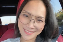 Bị bỏng mặt nặng, Hồng Ngọc “lột xác” xinh bất ngờ nhất 2020