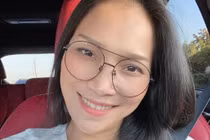 Bị bỏng mặt nặng, Hồng Ngọc “lột xác” xinh bất ngờ nhất 2020