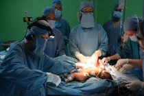 Nghẹt thở theo dõi ca phẫu thuật tách rời cặp song sinh dính liền phần gan 