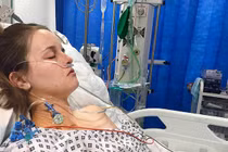 Cô gái 25 tuổi phải cắt nửa gan vì uống thuốc tránh thai theo cách này