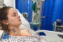 Cô gái 25 tuổi phải cắt nửa gan vì uống thuốc tránh thai theo cách này