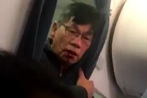 United Airlines sẽ bồi thường thế nào cho bác sỹ gốc Việt?