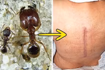 10 sự thật khiến bạn cảm thấy may mắn khi không sống thời quá khứ