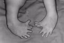 Tiết lộ “biệt dược quái đản” của Đức quốc xã 