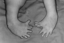 Tiết lộ “biệt dược quái đản” của Đức quốc xã 