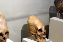 Giải mã sốc về hộp sọ bí ẩn của người ngoài hành tinh