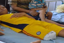 Đình chỉ kíp trực khiến nam thiếu niên bị cắt chân oan uổng