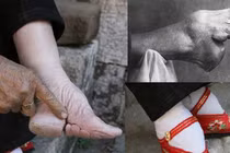 Té ngửa những trào lưu chết chóc của người xưa