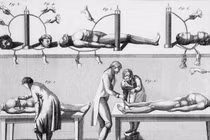 Rợn người thí nghiệm hồi sinh xác chết chấn động lịch sử 