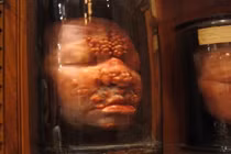 Những hiện vật rùng rợn trong bảo tàng y khoa Mỹ