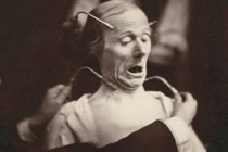 Ảnh gây sốc về thí nghiệm trên cơ thể người thời xưa