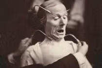 Ảnh gây sốc về thí nghiệm trên cơ thể người thời xưa