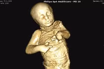 Hình ảnh giật mình bên trong những xác chết hóa đá 