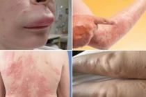 “Thà chết còn hơn” với 4 căn bệnh tái phát khi trời rét