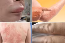 “Thà chết còn hơn” với 4 căn bệnh tái phát khi trời rét