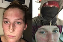 Kỳ lạ cô gái mắc bệnh nếu không được "ngủ đông" có thể chết 