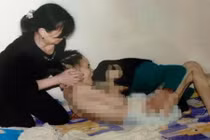 Nghi án nữ sinh xinh đẹp bị người yêu đánh phù não