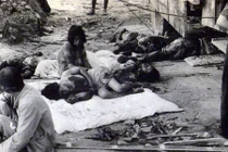 Đau lòng ảnh nạn nhân vụ Mỹ thả bom nguyên tử xuống Nhật