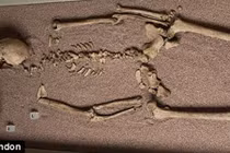 Phát hiện chấn động bộ xương phụ nữ mang nhiễm sắc thể nam