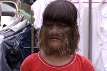 Sự thực khó tin về “người sói” có thật trong lịch sử