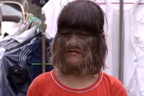 Sự thực khó tin về “người sói” có thật trong lịch sử