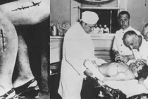 Top thí nghiệm “quỷ dữ” từng được thử nghiệm trên con người