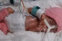 Những em bé lập kỷ lục thế giới từ khi mới sinh ra