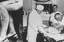 Rùng mình thí nghiệm trên cơ thể người của Đức quốc xã