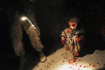 Loạt ảnh lột trần sự thật khủng khiếp của cuộc sống loài người 