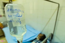 Dấu hiệu chứng tỏ bạn đã nhiễm HIV