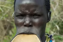 Quái chiêu quàng miệng làm đẹp 