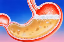 6 dấu hiệu phổ biến cảnh báo dạ dày gặp vấn đề