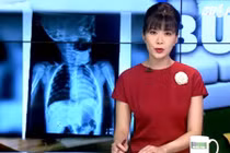 Kinh hoàng phát hiện tụ điện trong phế quản bé 8 tháng tuổi 