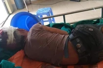 Hà Giang: Hai con thoát chết thần kỳ khi bỗng dưng bị bố “xuống tay”