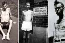 Thí nghiệm phi nhân tính của quân đội Mỹ sau CTTG 2