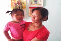 Cô giáo bị tố đánh bé gái 3 tuổi méo mồm