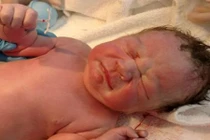 Làm sao đã đặt vòng mà vẫn có thai bình thường