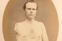 Quặn lòng hình ảnh binh lính sau Nội chiến Mỹ