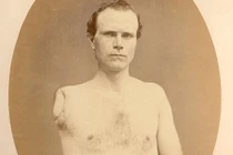 Quặn lòng hình ảnh binh lính sau Nội chiến Mỹ