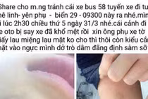 Sa thải phụ xe buýt tát nữ sinh thâm tím mặt