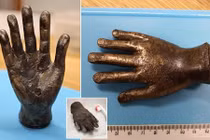 Phát hiện gây sốc về bàn tay 2,3 kg của người La Mã 