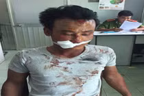 Trai trẻ “ngáo đá” chém lia lịa trọng thương nhiều người